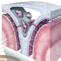 Medical illustration dural venous sinus thumbnail