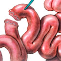 medical illustration 