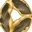 medical illustration aortic valve stenosis thumbnail